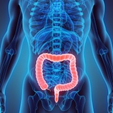 colitis1